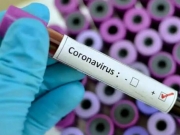 В Беларуси коронавирусом заразились более 300 медиков