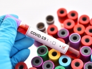 Коронавирус в Украине: новый рекорд — более 16 тысяч инфицирований в сутки