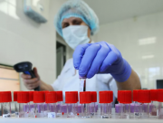 В Украине подтверждено более четырех тысяч случаев инфицирования коронавирусом