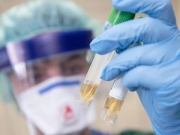 В Украине выявили больше 15 тысяч новых случаев коронавируса