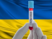 В Украине зарегистрировано 73 случая инфицирования коронавирусом — МОЗ
