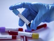 Число случаев заражения коронавирусом в Украине возросло до 84 — Минздрав