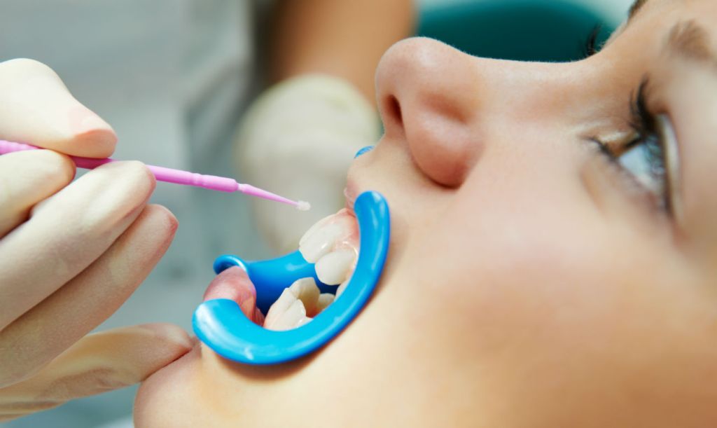 Профилактика и лечение молочных зубов в профессиональной клинике