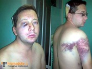 Суд в Киеве арестовывает избитых и непричастных