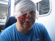 После митингов в Донецке к врачам обратились 28 человек
