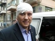 В Черновцах избили экс-главу фракции «Свобода» в облсовете