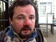 Киевская милиция избила и задержала съемочную группу «Радио Свобода»
