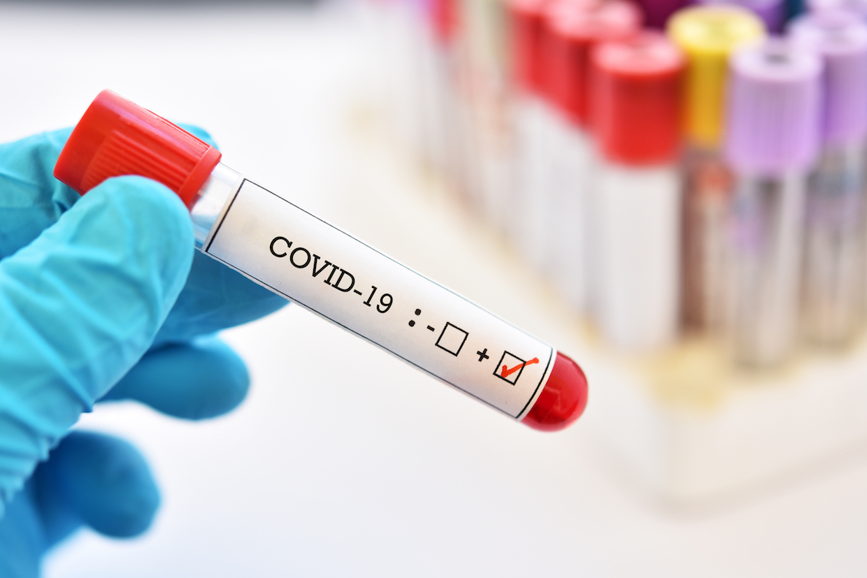 В Украине зафиксировано более 8000 больных коронавирусом COVID-19