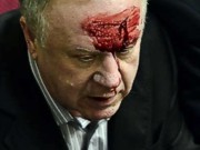 В Верховной раде избили депутатов Кубива и Малышева