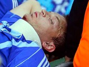 Гусеву сломали челюсть во время игры с «Днепром»