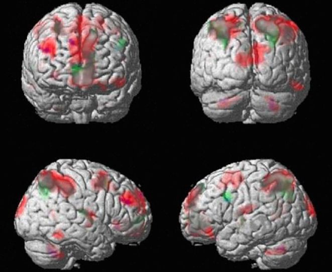 как наркотики влияет на мозг